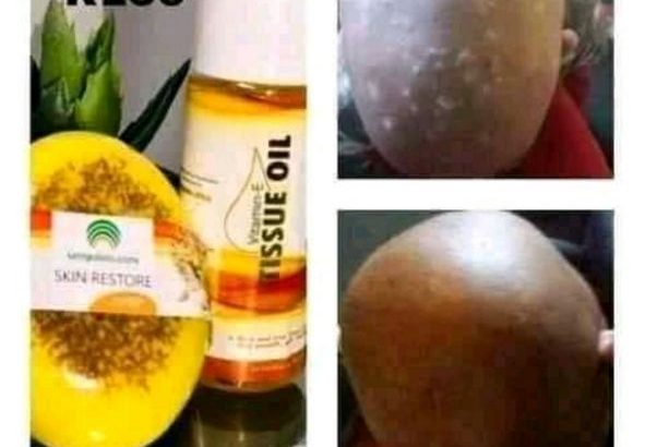 Umgalelo Skincare Products