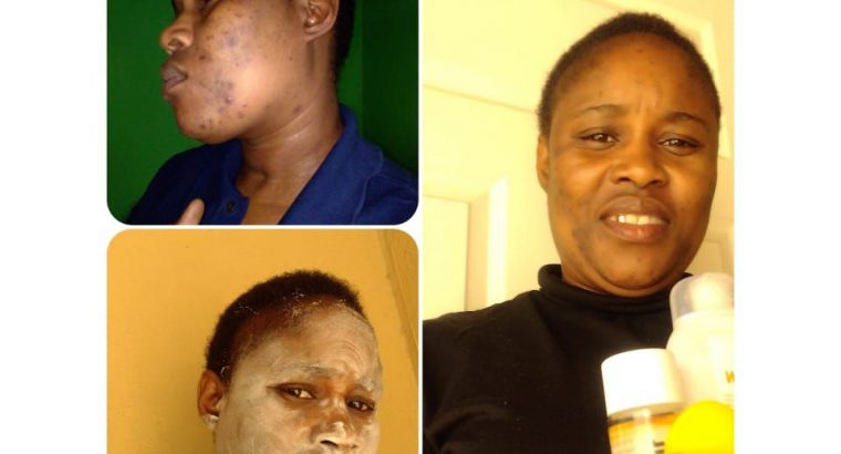 Umgalelo Skin Products