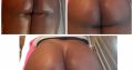 Boob and buttlift