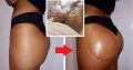 Boob and buttlift