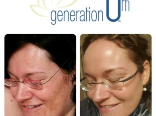 UTH Skin Range (Natural Products)