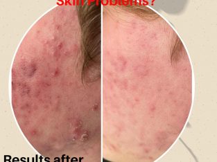 Skin Problems?