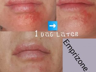 Emprizone Gel