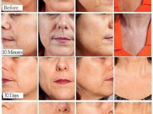 Ante Ageing Firm