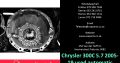 Chrysler 300C 5.7 2005-19 used automatic gearbox for sale