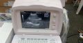 Mindray dp 2200 ultrasound machine