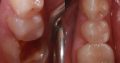 Teeth treatment near me
