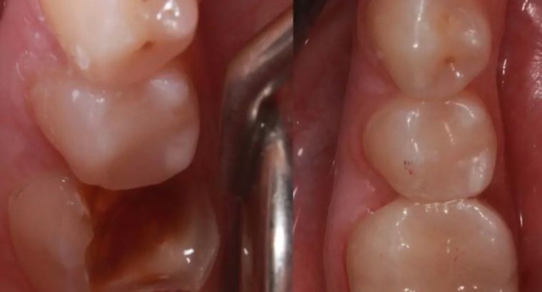 Teeth treatment near me