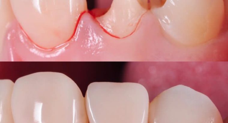 Dental treatment in Kampala