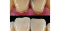 Teeth treatment in Kampala
