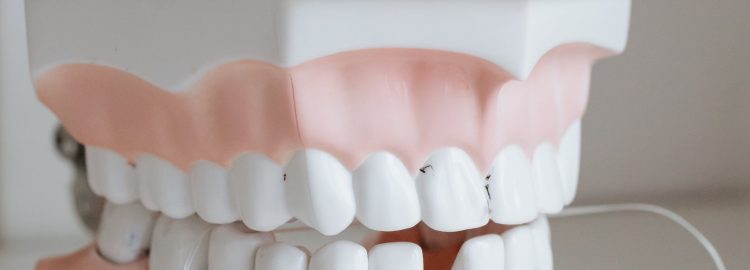 teeth whitening products